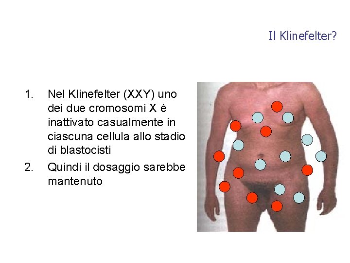 Il Klinefelter? 1. 2. Nel Klinefelter (XXY) uno dei due cromosomi X è inattivato