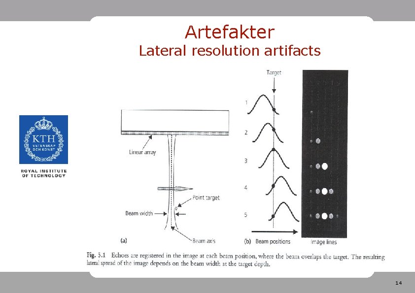 Artefakter Lateral resolution artifacts 14 Artefakter Lateral resolution artifacts 14