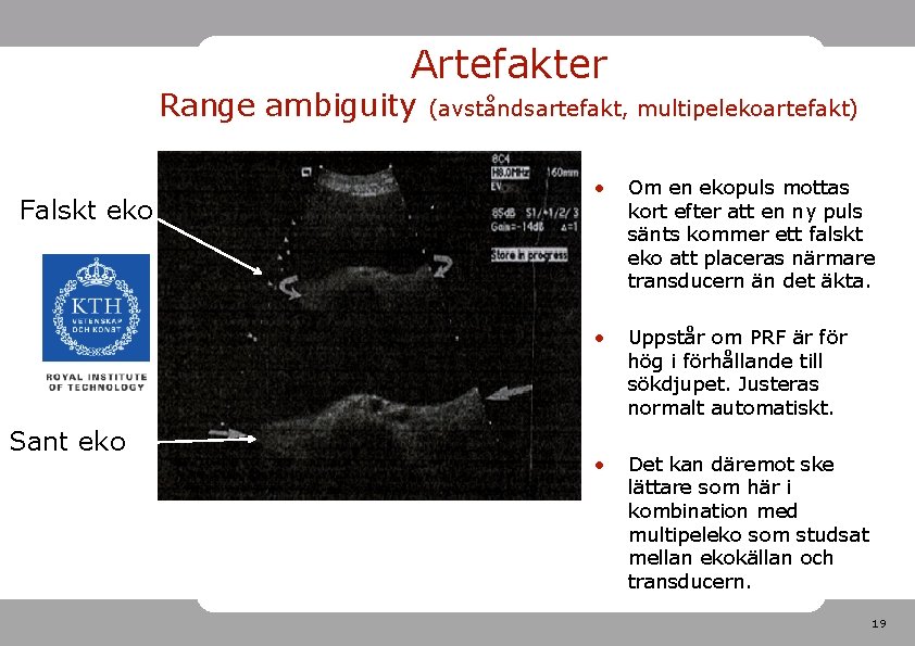 Artefakter Range ambiguity Falskt eko Sant eko (avståndsartefakt, multipelekoartefakt) • Om en ekopuls mottas