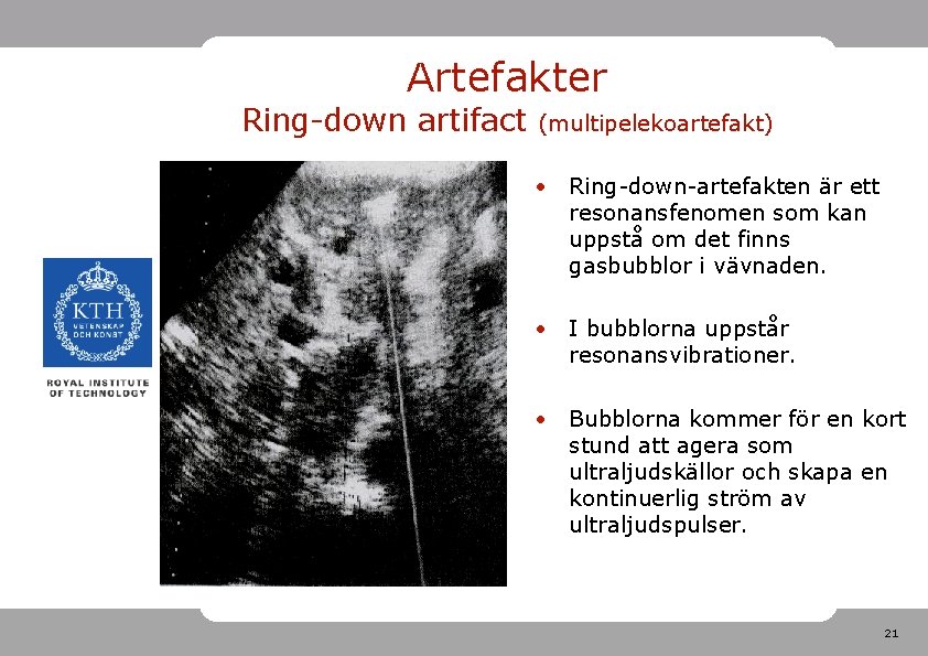 Artefakter Ring-down artifact (multipelekoartefakt) • Ring-down-artefakten är ett resonansfenomen som kan uppstå om det