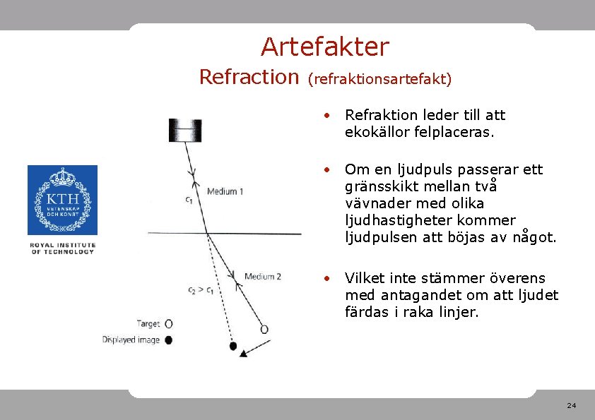 Artefakter Refraction (refraktionsartefakt) • Refraktion leder till att ekokällor felplaceras. • Om en ljudpuls