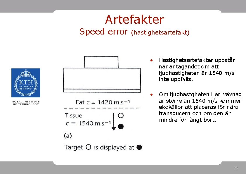 Artefakter Speed error (hastighetsartefakt) • Hastighetsartefakter uppstår när antagandet om att ljudhastigheten är 1540 Artefakter Speed error (hastighetsartefakt) • Hastighetsartefakter uppstår när antagandet om att ljudhastigheten är 1540