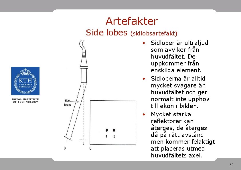 Artefakter Side lobes (sidlobsartefakt) • Sidlober är ultraljud som avviker från huvudfältet. De uppkommer