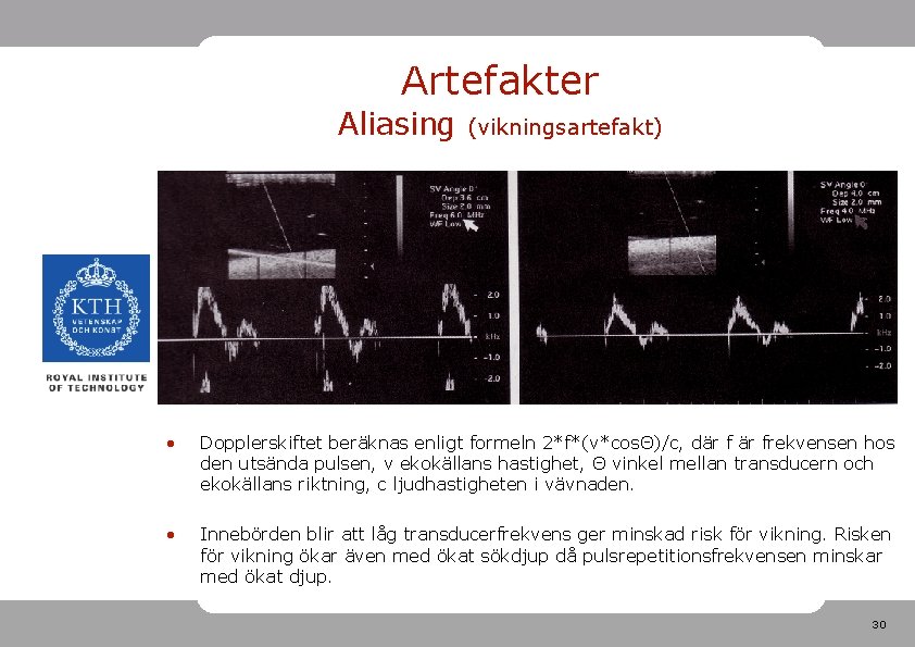 Artefakter Aliasing (vikningsartefakt) • Dopplerskiftet beräknas enligt formeln 2*f*(v*cosΘ)/c, där frekvensen hos den utsända