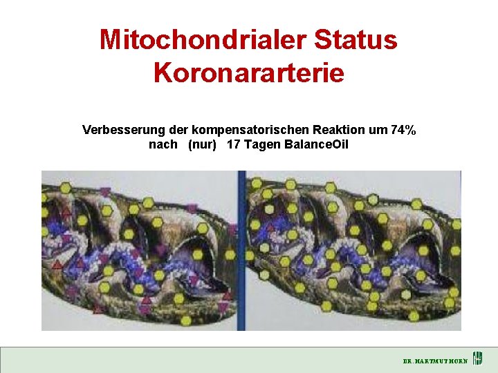 Mitochondrialer Status Koronararterie Verbesserung der kompensatorischen Reaktion um 74% nach (nur) 17 Tagen Balance.