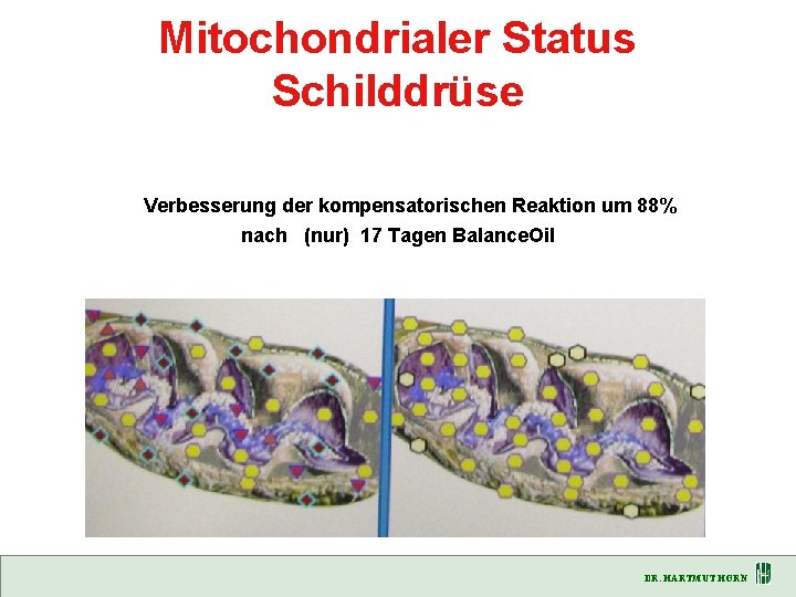 Mitochondrialer Status Schilddrüse Verbesserung der kompensatorischen Reaktion um 88% nach (nur) 17 Tagen Balance.