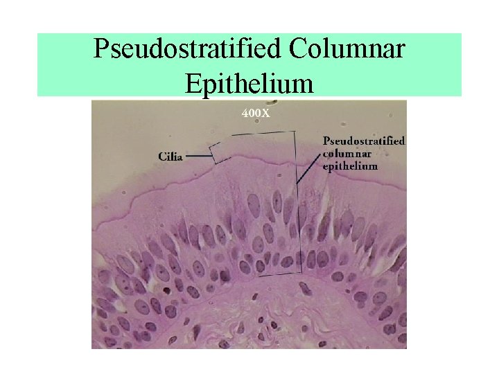 Pseudostratified Columnar Epithelium Pseudostratified Columnar Epithelium