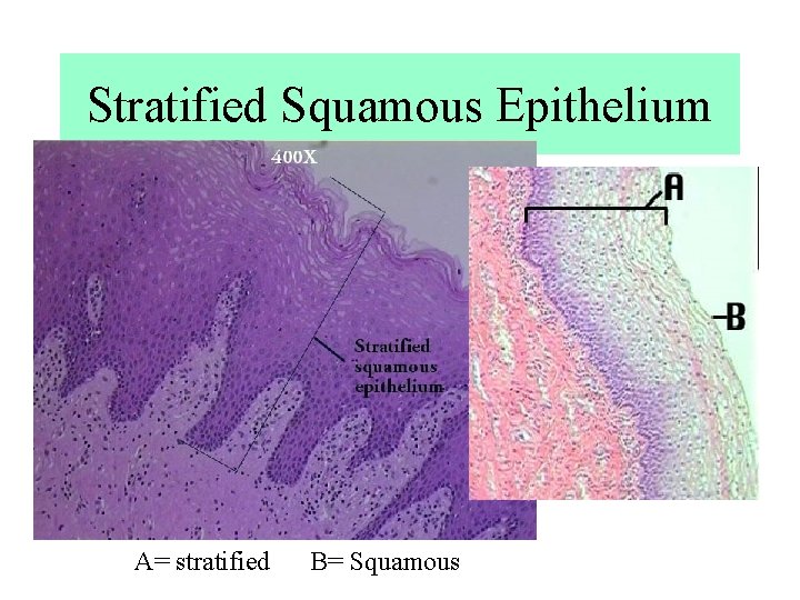 Stratified Squamous Epithelium A= stratified B= Squamous Stratified Squamous Epithelium A= stratified B= Squamous