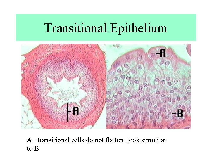 Transitional Epithelium A= transitional cells do not flatten, look simmilar to B Transitional Epithelium A= transitional cells do not flatten, look simmilar to B