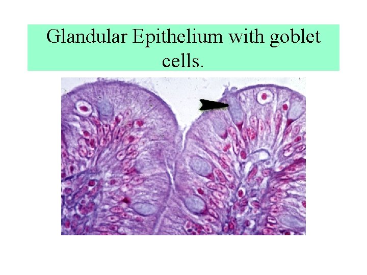 Glandular Epithelium with goblet cells. Glandular Epithelium with goblet cells.