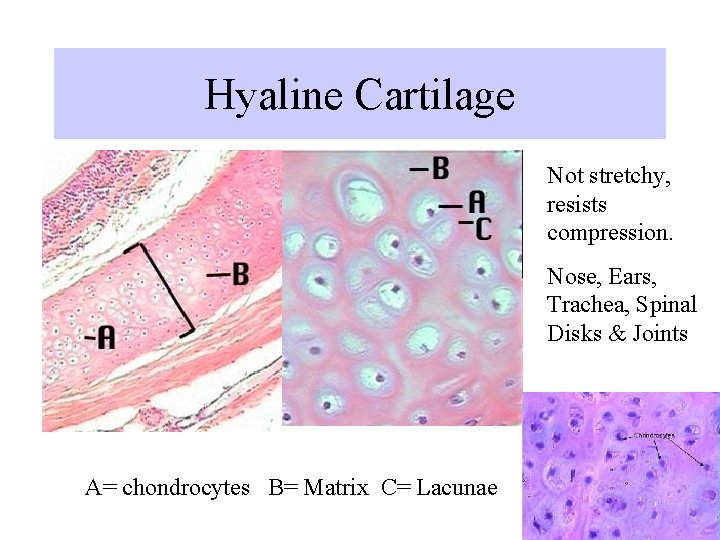 Hyaline Cartilage Not stretchy, resists compression. Nose, Ears, Trachea, Spinal Disks & Joints A= Hyaline Cartilage Not stretchy, resists compression. Nose, Ears, Trachea, Spinal Disks & Joints A=