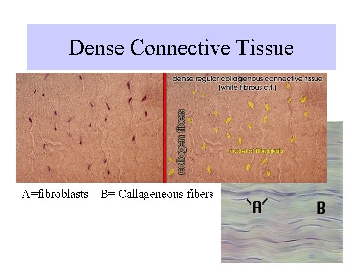 Dense Connective Tissue A=fibroblasts B= Callageneous fibers Dense Connective Tissue A=fibroblasts B= Callageneous fibers