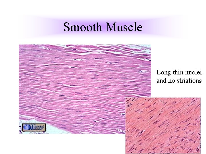 Smooth Muscle Long thin nuclei and no striations Smooth Muscle Long thin nuclei and no striations