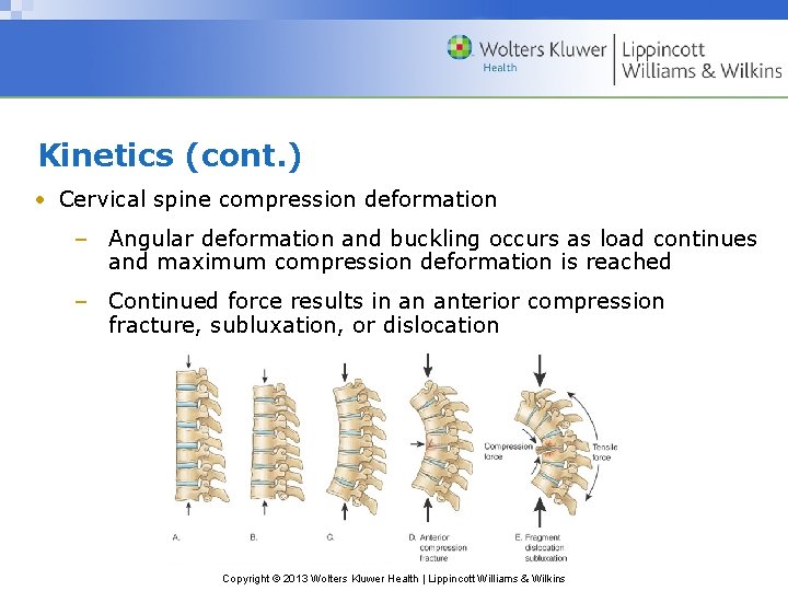 Kinetics (cont. ) • Cervical spine compression deformation – Angular deformation and buckling occurs