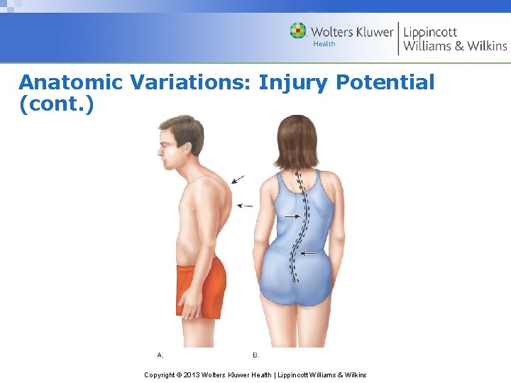 Anatomic Variations: Injury Potential (cont. ) Copyright © 2013 Wolters Kluwer Health | Lippincott