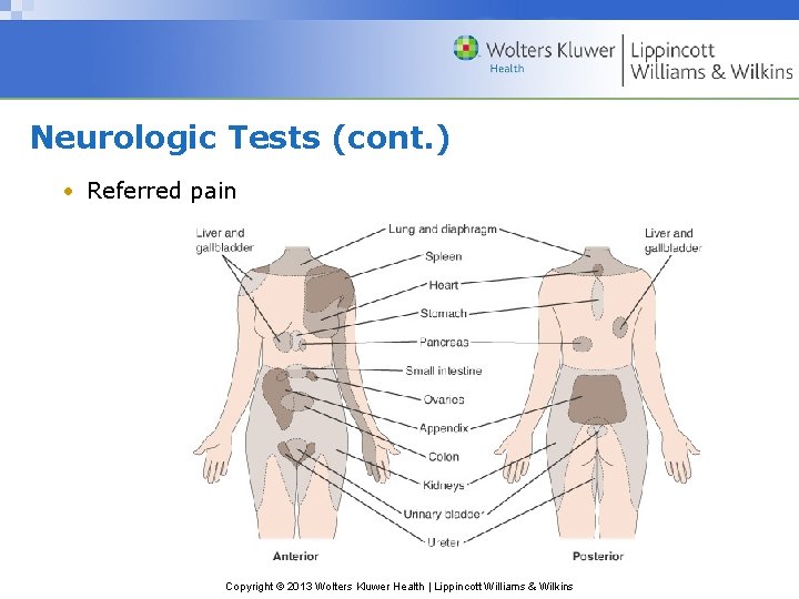 Neurologic Tests (cont. ) • Referred pain Copyright © 2013 Wolters Kluwer Health |