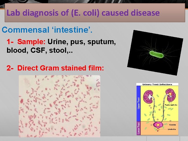 Lab diagnosis of (E. coli) caused disease Commensal ‘intestine’. 1 - Sample: Urine, pus,
