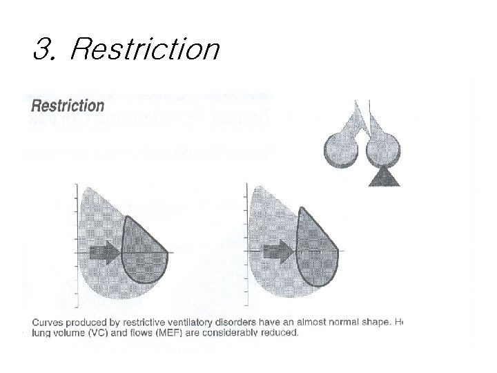 3. Restriction 3. Restriction