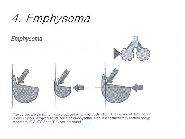 4. Emphysema 4. Emphysema