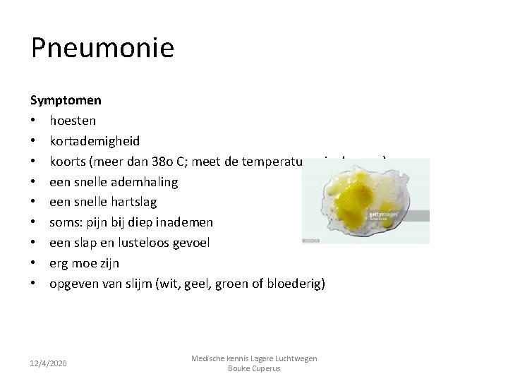 Pneumonie Symptomen • hoesten • kortademigheid • koorts (meer dan 38 o C; meet