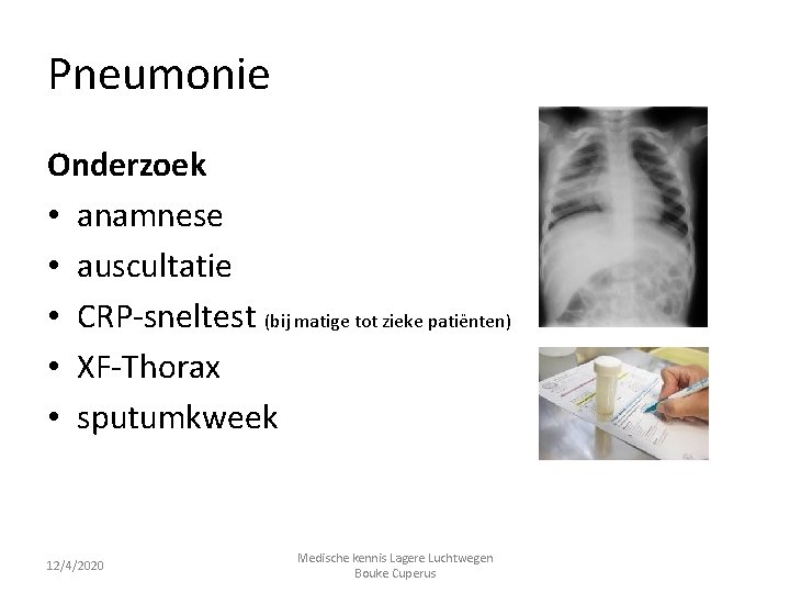 Pneumonie Onderzoek • anamnese • auscultatie • CRP-sneltest (bij matige tot zieke patiënten) •