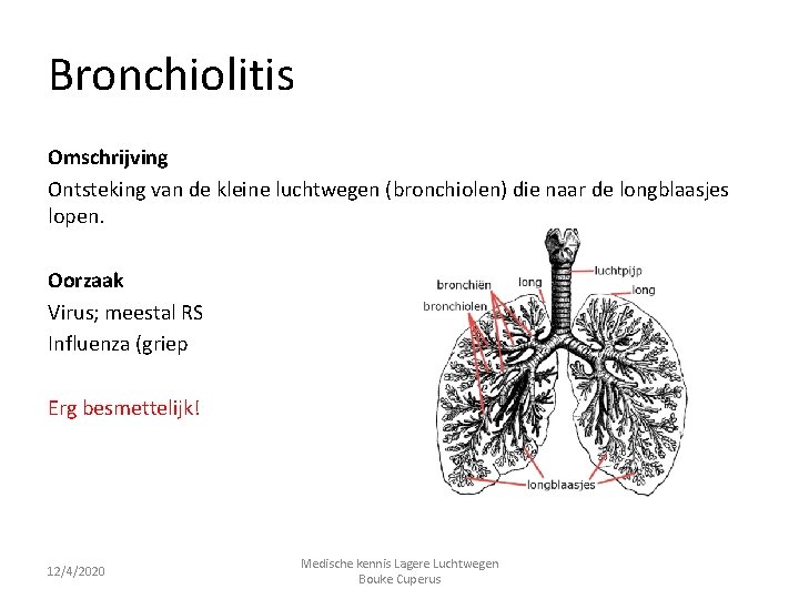 Bronchiolitis Omschrijving Ontsteking van de kleine luchtwegen (bronchiolen) die naar de longblaasjes lopen. Oorzaak