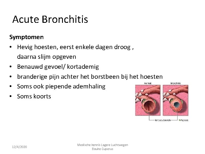 Acute Bronchitis Symptomen • Hevig hoesten, eerst enkele dagen droog , daarna slijm opgeven