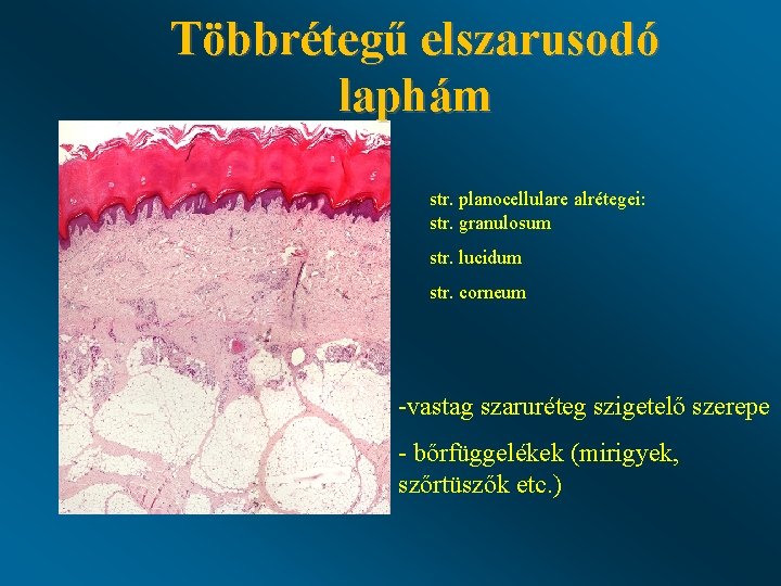 Többrétegű elszarusodó laphám str. planocellulare alrétegei: str. granulosum str. lucidum str. corneum -vastag szaruréteg Többrétegű elszarusodó laphám str. planocellulare alrétegei: str. granulosum str. lucidum str. corneum -vastag szaruréteg