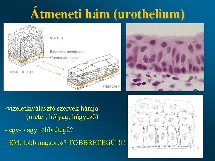 Átmeneti hám (urothelium) -vizeletkiválasztó szervek hámja (ureter, hólyag, húgycső) - egy- vagy többrétegű? - Átmeneti hám (urothelium) -vizeletkiválasztó szervek hámja (ureter, hólyag, húgycső) - egy- vagy többrétegű? -