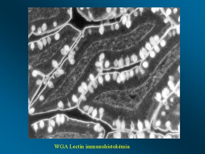 WGA Lectin immunohistokémia 