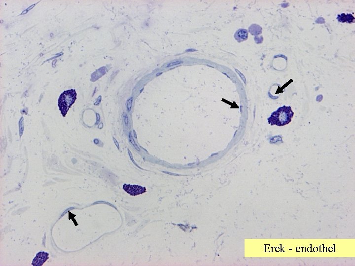 Erek - endothel 