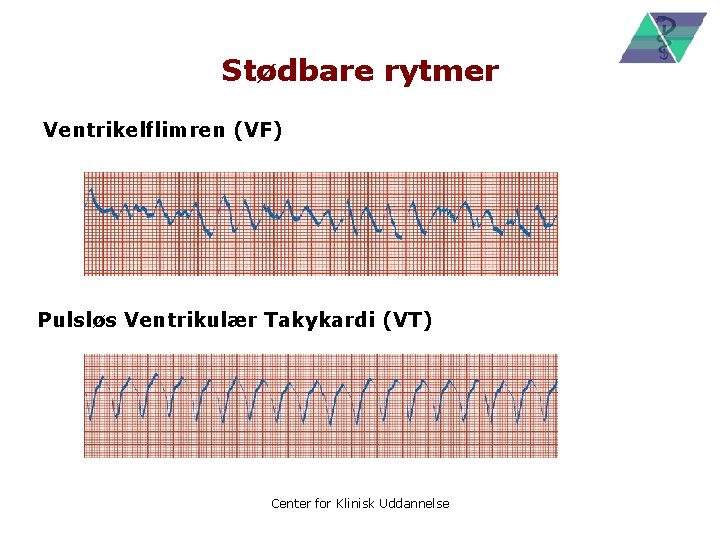 Stødbare rytmer Ventrikelflimren (VF) Pulsløs Ventrikulær Takykardi (VT) Center for Klinisk Uddannelse 