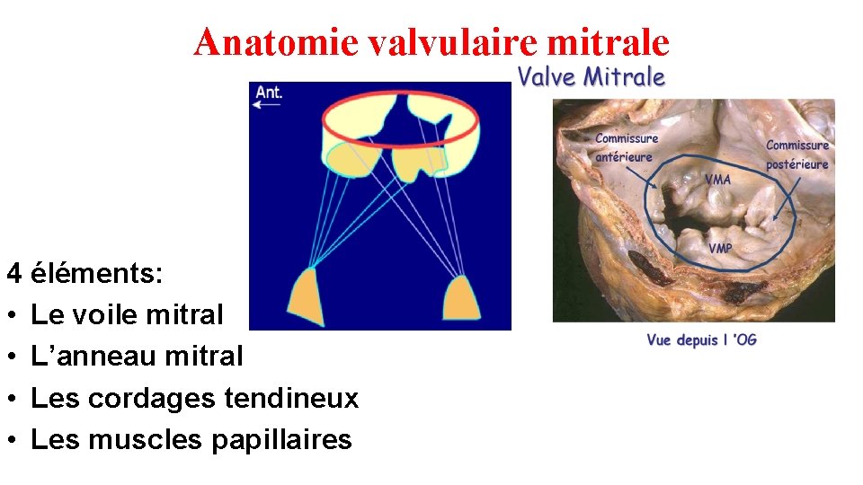 Anatomie valvulaire mitrale 4 éléments: • Le voile mitral • L’anneau mitral • Les