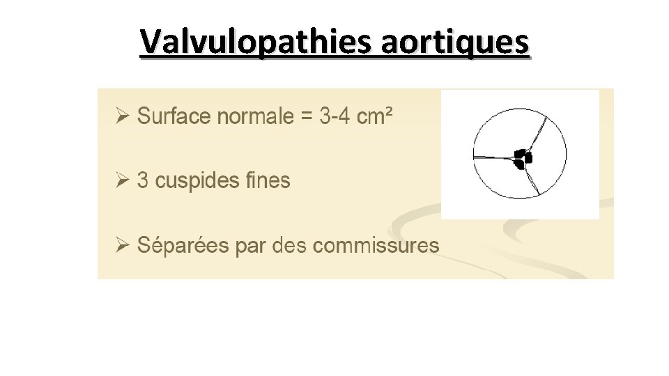 Valvulopathies aortiques 