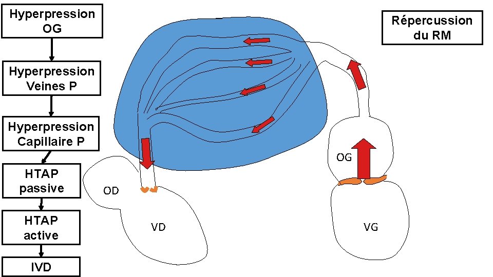 Hyperpression OG Répercussion du RM Hyperpression Veines P Hyperpression Capillaire P OG HTAP passive