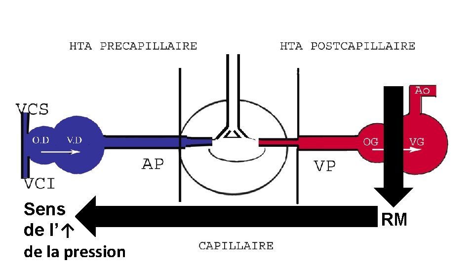 Sens de l’↑ de la pression RM 