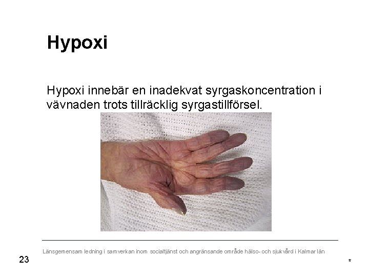 Hypoxi innebär en inadekvat syrgaskoncentration i vävnaden trots tillräcklig syrgastillförsel. * 23 Länsgemensam ledning