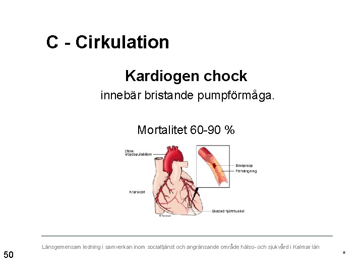 C - Cirkulation Kardiogen chock innebär bristande pumpförmåga. Mortalitet 60 -90 % 50 Länsgemensam