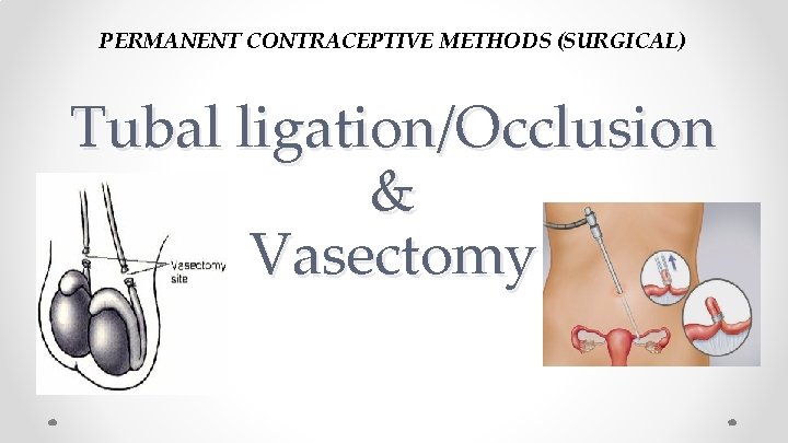 PERMANENT CONTRACEPTIVE METHODS (SURGICAL) Tubal ligation/Occlusion & Vasectomy 