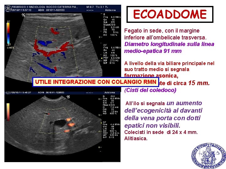 ECOADDOME Fegato in sede, con il margine inferiore all’ombelicale trasversa. Diametro longitudinale sulla linea ECOADDOME Fegato in sede, con il margine inferiore all’ombelicale trasversa. Diametro longitudinale sulla linea
