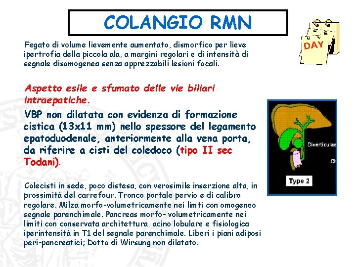 COLANGIO RMN Fegato di volume lievemente aumentato, dismorfico per lieve ipertrofia della piccola ala, COLANGIO RMN Fegato di volume lievemente aumentato, dismorfico per lieve ipertrofia della piccola ala,