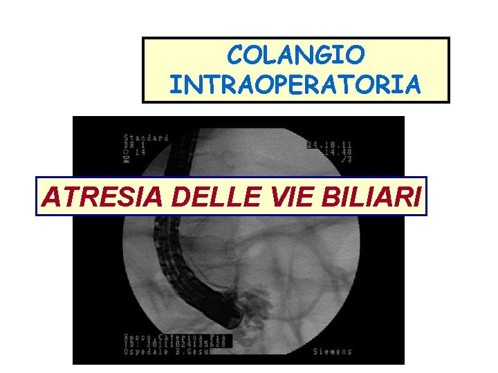 COLANGIO INTRAOPERATORIA ATRESIA DELLE VIE BILIARI COLANGIO INTRAOPERATORIA ATRESIA DELLE VIE BILIARI