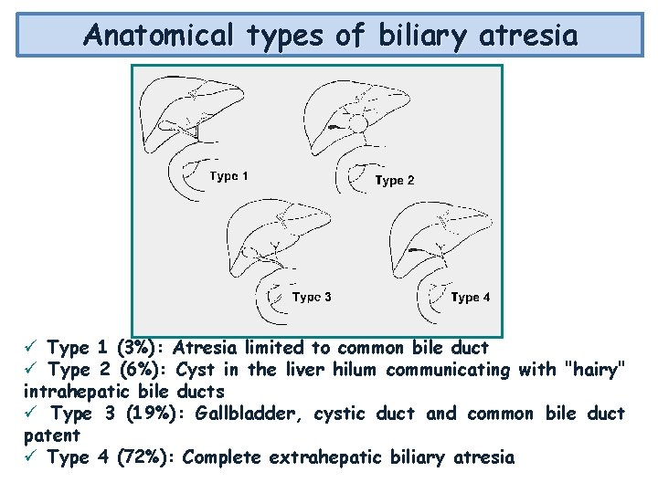 Anatomical types of biliary atresia Type 1 (3%): Atresia limited to common bile duct Anatomical types of biliary atresia Type 1 (3%): Atresia limited to common bile duct
