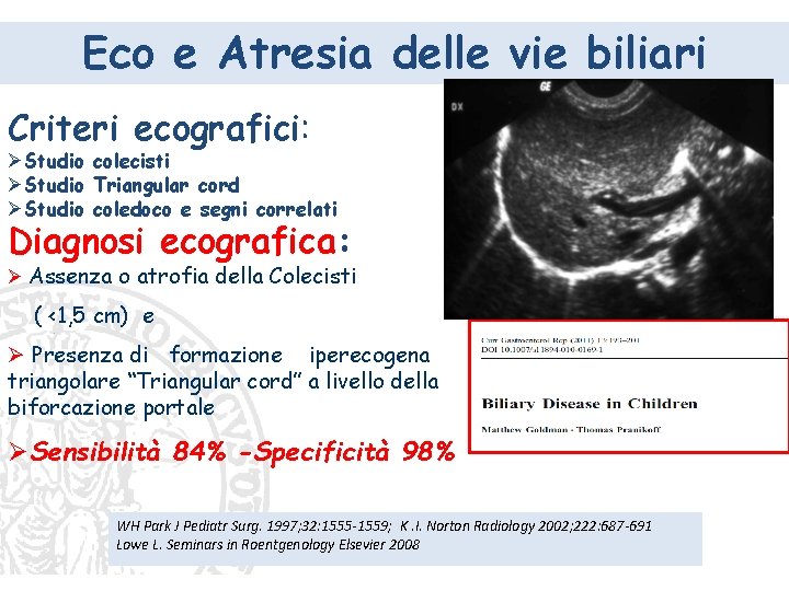 Eco e Atresia delle vie biliari Criteri ecografici: ØStudio colecisti ØStudio Triangular cord ØStudio Eco e Atresia delle vie biliari Criteri ecografici: ØStudio colecisti ØStudio Triangular cord ØStudio
