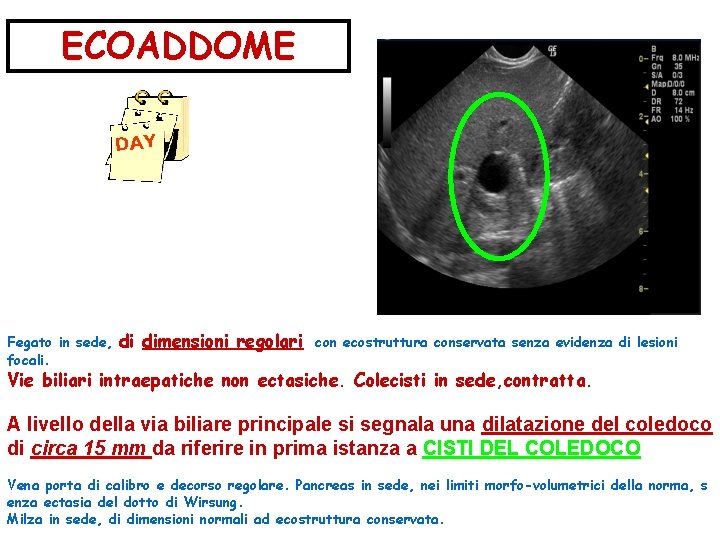 ECOADDOME DAY Fegato in sede, focali. di dimensioni regolari con ecostruttura conservata senza evidenza ECOADDOME DAY Fegato in sede, focali. di dimensioni regolari con ecostruttura conservata senza evidenza