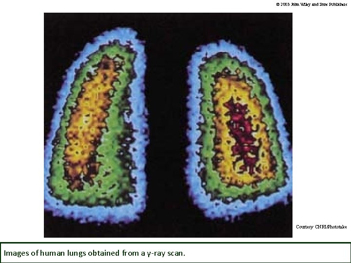 © 2003 John Wiley and Sons Publishers Courtesy CNRI/Phototake Images of human lungs obtained