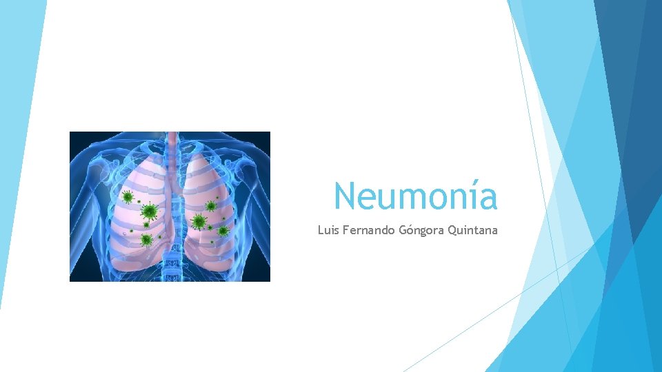 Neumonía Luis Fernando Góngora Quintana 