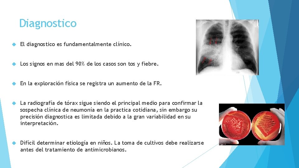 Diagnostico El diagnostico es fundamentalmente clínico. Los signos en mas del 90% de los