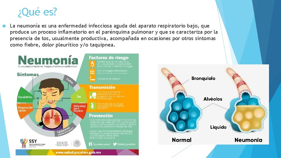 ¿Qué es? La neumonía es una enfermedad infecciosa aguda del aparato respiratorio bajo, que