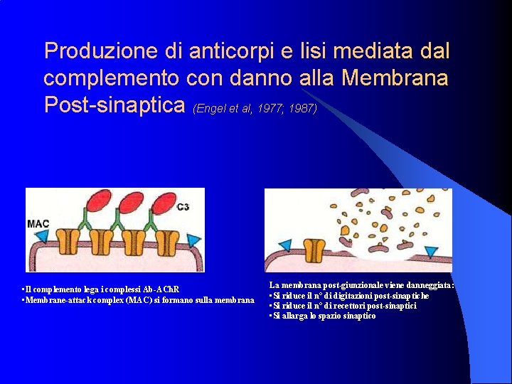 Produzione di anticorpi e lisi mediata dal complemento con danno alla Membrana Post-sinaptica (Engel